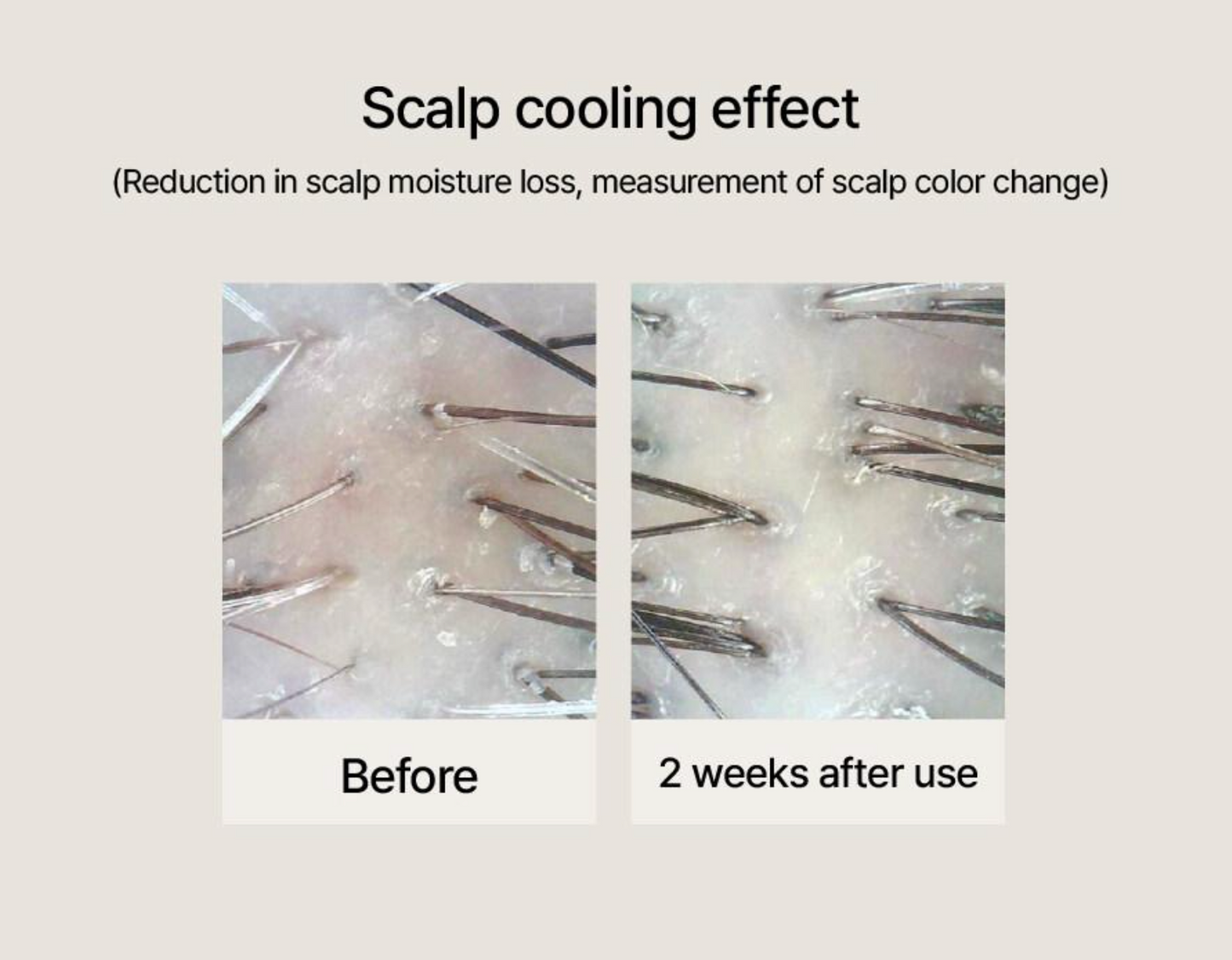 【AROMATICA】 TEA TREE PURIFYING TONIC 100ml