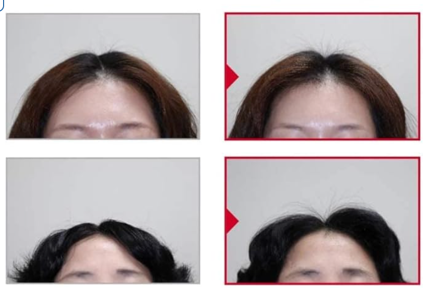 【Dr.FORHAIR】 Folligen Plus Shampoo 500ml