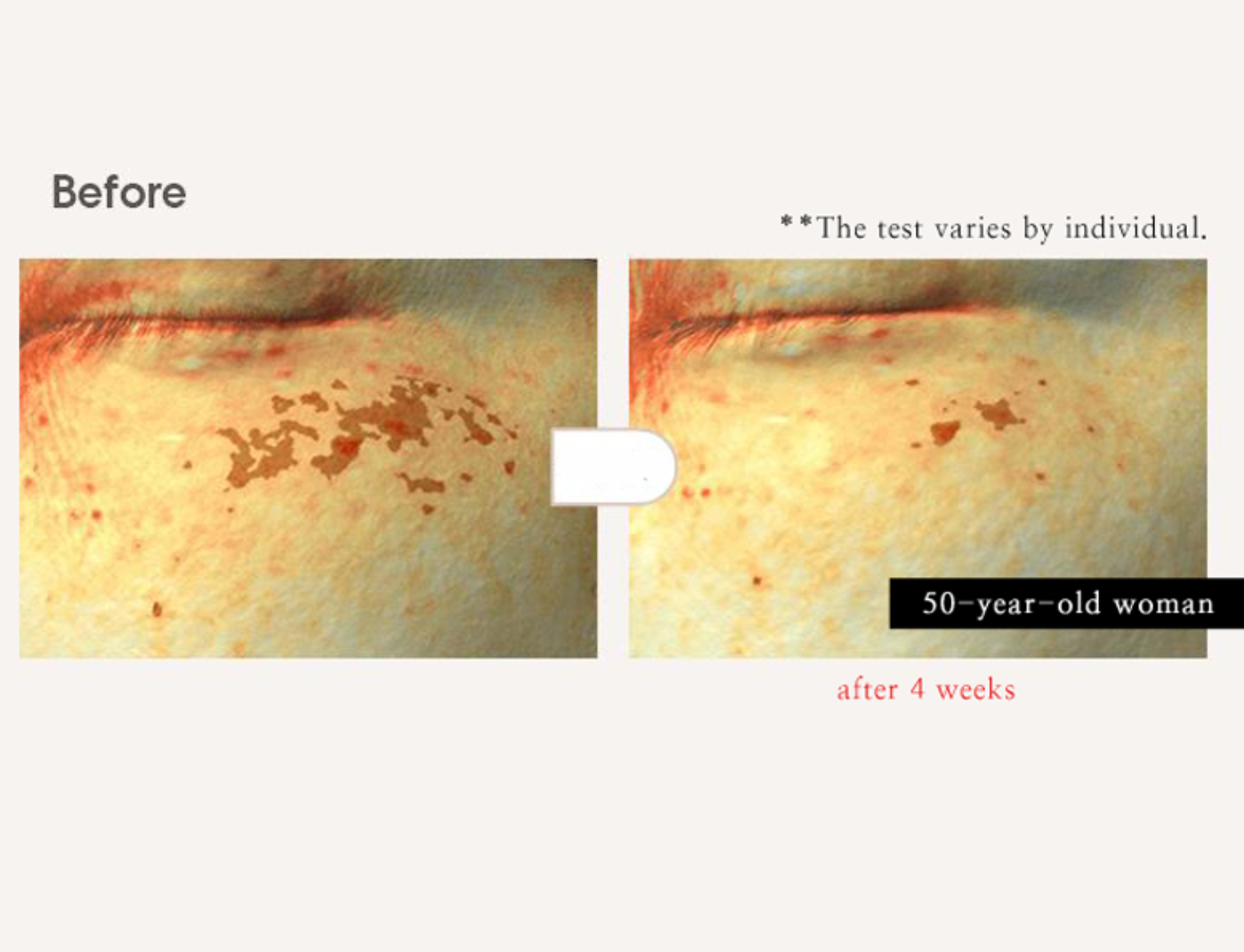 AHC H Mela Root Cream Special Set (50ml + 10ml + Cotton Swab 2ea)