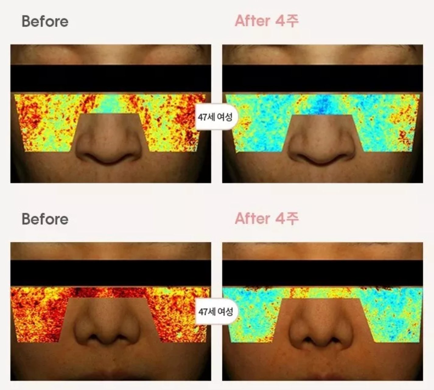 AHC H Mela Root Cream Special Set (50ml + 10ml + Cotton Swab 2ea)