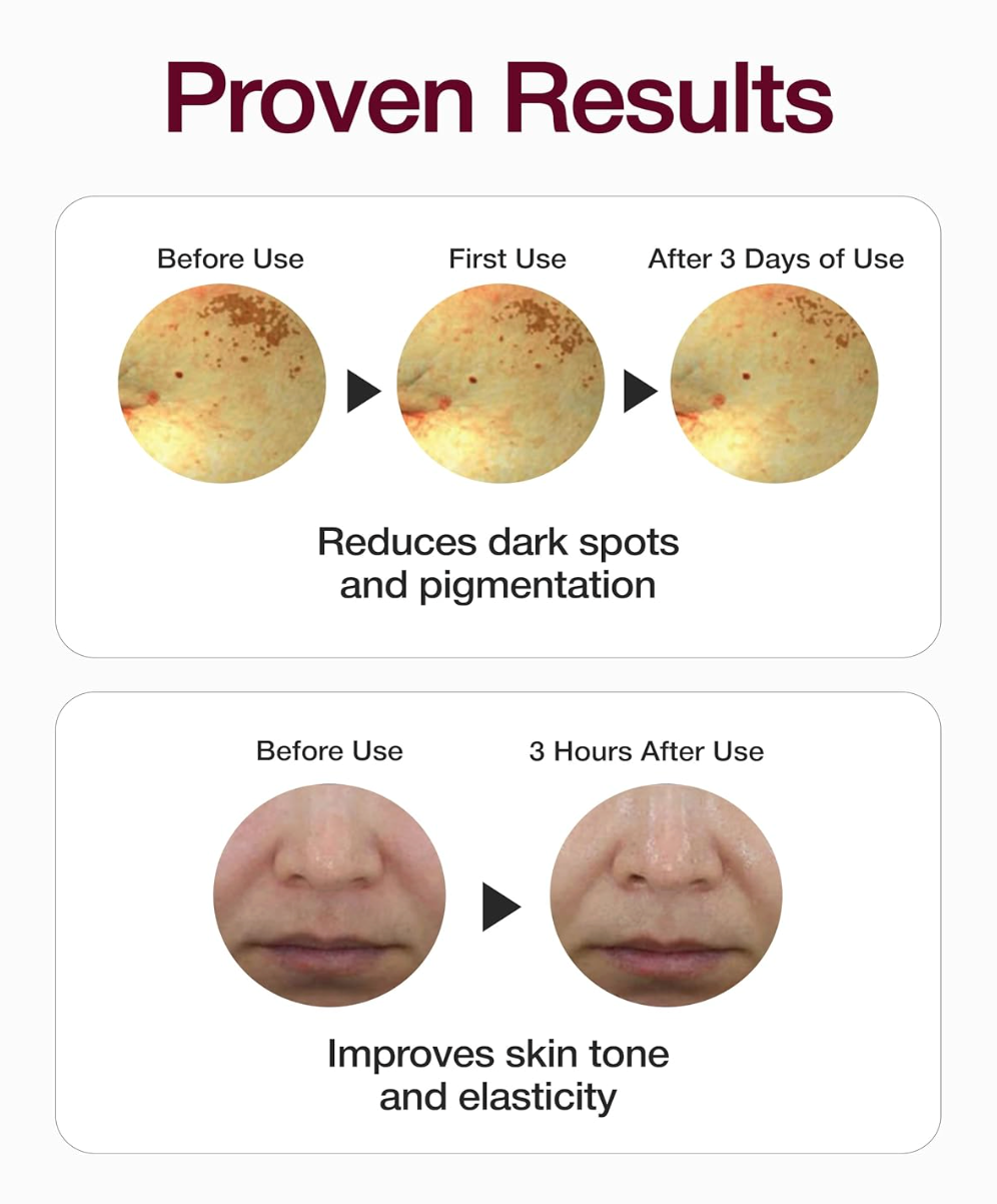 Centellian 24 Expert Madeca Mela Capture Ampoule Max / ampoule 38ml + ampoule pad 10ea