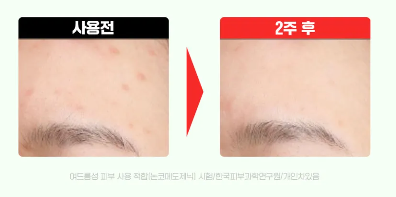 【FATION】 Nosca9 Trouble Toning Ampoule 30ml Set (+Trouble Serum 15ml)