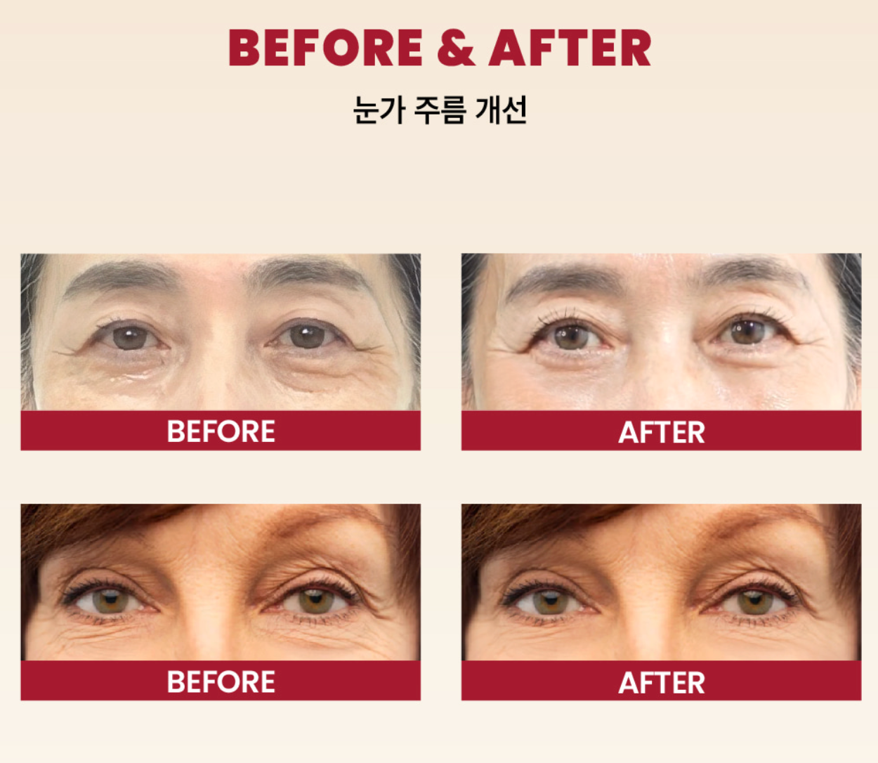 【SEOUL 1988】 Eye Cream : Retinal Liposome 4% + Fermented Bean (30ml)