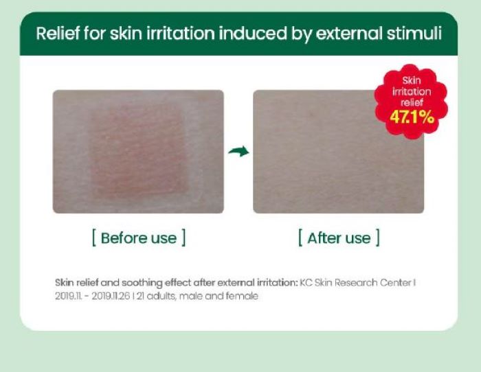 【Dr.G】 Red Blemish Clear Soothing Active Essence 80ml